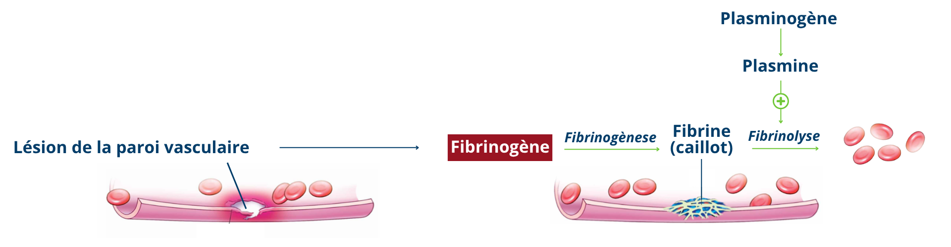 Equilibre fibrinogene-fibrine